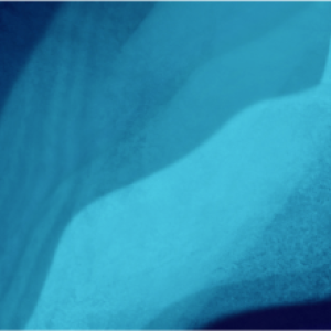 blue background